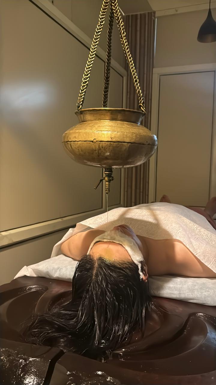 shirodhara-therapy