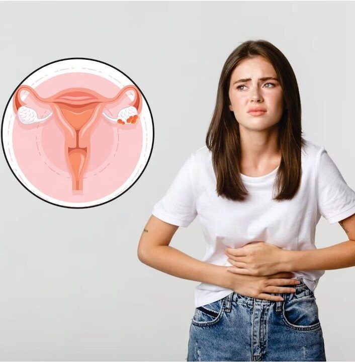 PCOS-ayurvedic-treatment-in-rishikesh